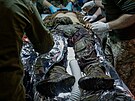 Ukrajin�tí medici o�et�ují vojáka zran�ného u Avdijivky. (16. listopadu 2023) 