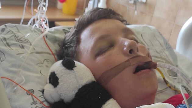 Lkai Fakultn nemocnice Ostrava zachrnili Danielu tvrtkovi ivot po tkm razu hlavy.
