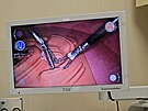 Na brnnsk klinice provede operace nov robotick systm