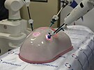 Robotick systm Versius bude od ledna 2024 v brnnsk SurGal Clinic slouit k...