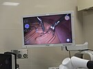 Robotick systm Versius bude od ledna 2024 v brnnsk SurGal Clinic slouit k...