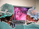 Mezi Centra vysoce specializovan� pneumoonkochirurgick� p��e byla za�azena i I....