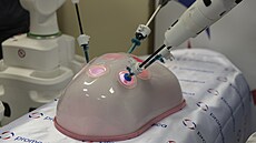 Robotický systém Versius bude od ledna 2024 v brnnské SurGal Clinic slouit k...