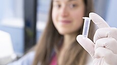 DNA zvládne hodn�. I dvou týdenní cestu po�tou. (22. listopadu 2023)