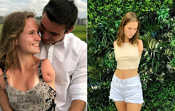 Narodila se bez rukou. I p�es hendikep zvládá v�ci jako lidé se v�emi...