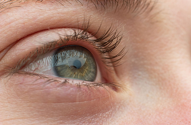 Zelený zákal vás může připravit o zrak. Pozor na varovné příznaky