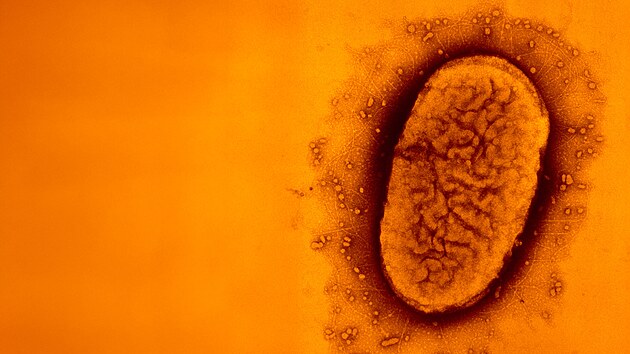 Elektronov mikrofotografie bakterie zpsobujc ern kael, Bordetella pertussis v nepravch barvch