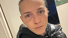 Boxerka Fabiána Bytyqi po zápase s Tinou Rupprechtovou, v n�m� ztratila sv�tový...