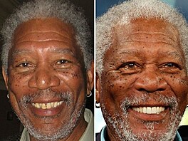 Herec Morgan Freeman uvedl, e kdyby ho k implantátm nedotlaila jeho tehdejí...