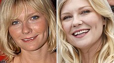 Here�ka Kirsten Dunstová na po�átku její kariéry (vlevo) a dnes. Zuby má o...