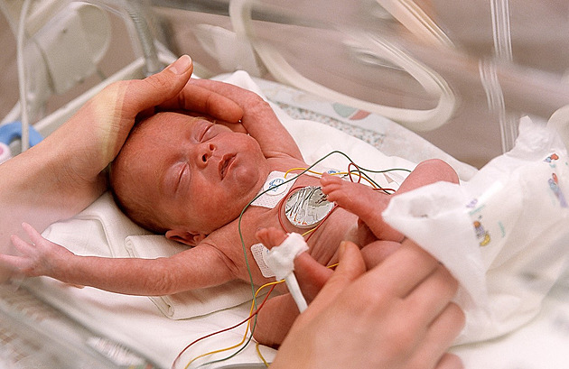 Třetina nedonošených dětí má psychické potíže, chybí péče, varuje lékařka