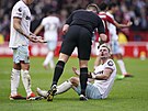 Vladimír Coufal z West Hamu s krvavým nosem a pusou v zápasu proti Nottinghamu.