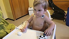 Richard. Malému chlapci pomáhá elektroakupuntura. Je jedním z mnoha d�tí s...