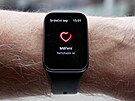 Xiaomi Smart Band 8 Pro