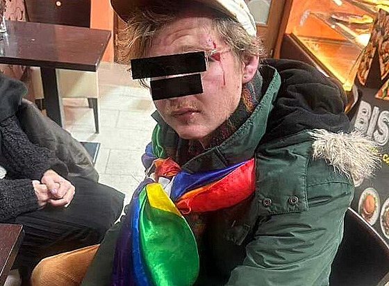 Napadený mu� skon�il po útoku s tr�nými ranami na hlav�.