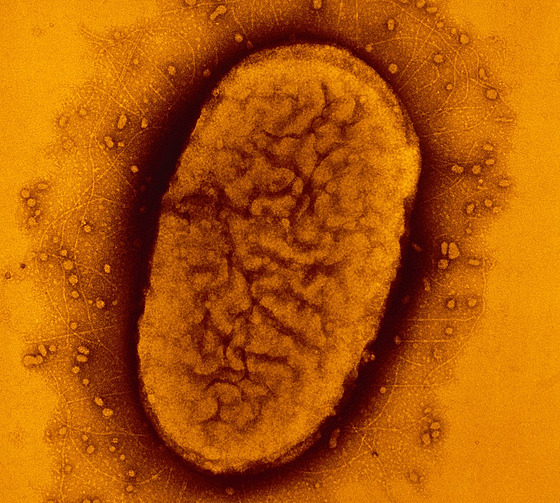 Bakterie Bordetella pertussis, která zpsobuje  vysoce nakalivý erný kael.