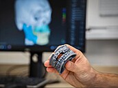 Model chrupu z 3D tiskárny pomáhá v ostravské fakultní nemocnici eit závané...