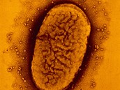 Bakterie Bordetella pertussis, která zpsobuje  vysoce nakalivý erný kael.