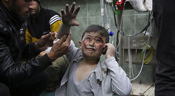 Rafáh. Palestinský chlapec zraněný při izraelském bombardování (24. března 2024)