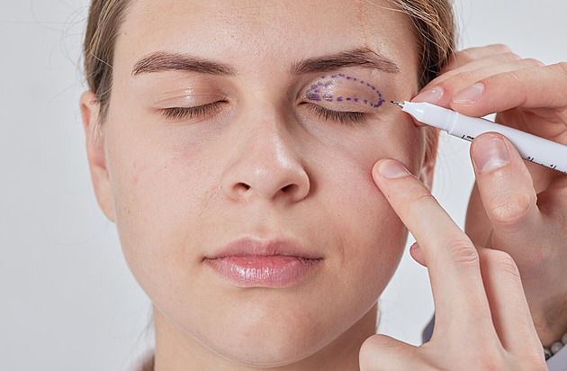 Operace očních víček není jen estetickou záležitostí. Hlavně lépe uvidíte