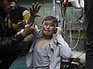 Rafáh. Palestinský chlapec zranný pi izraelském bombardování (24. bezna 2024)