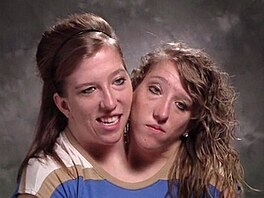 Abby a Brittany Henselovy