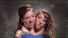 Abby a Brittany Henselovy