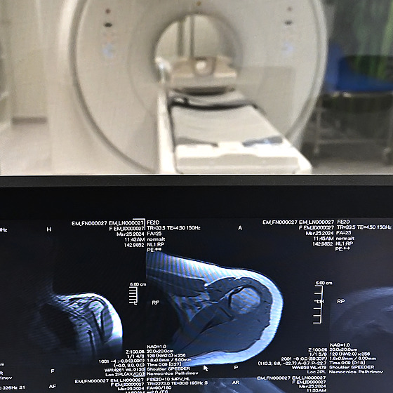 Nemocnice Pelhřimov má magnetickou rezonanci, zat­m v regionu chybÄla