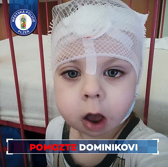 Dominik se narodil se vzácným onemocnním, jedná se o Goldenharv syndrom.