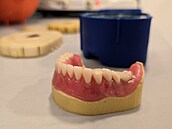 Výroba umlých zubních náhrad, které nejsou pipevnné napevno.
