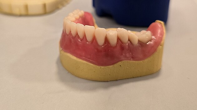 Výroba umlých zubních náhrad, které nejsou pipevnné napevno.