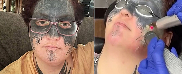 Tetování pořídil ženě bývalý partner bez souhlasu, nyní se ho zbavuje