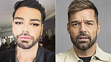 Mu� (vlevo) cht�l vypadat jako Ricky Martin (vpravo). Vsadil na plastiky.