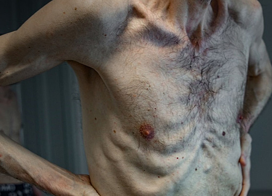 Ukrajinec Roman Vasiliovi� po propu�t�ní z ruského zajetí (4. �ervna 2024)