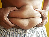 Obzvlát varovné jsou signály ohledn nadváhy a obezity u dtí a mladistvých.
