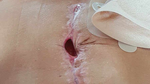 Belinda Ingeman Møllerov�