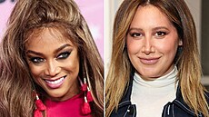 N�které slavné �eny u� se nemohly dívat na sv�j nos a rozhodly se pro plastiku.