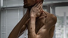 Ukrajinec Roman Vasiliovi� po propu�t�ní z ruského zajetí (4. �ervna 2024)