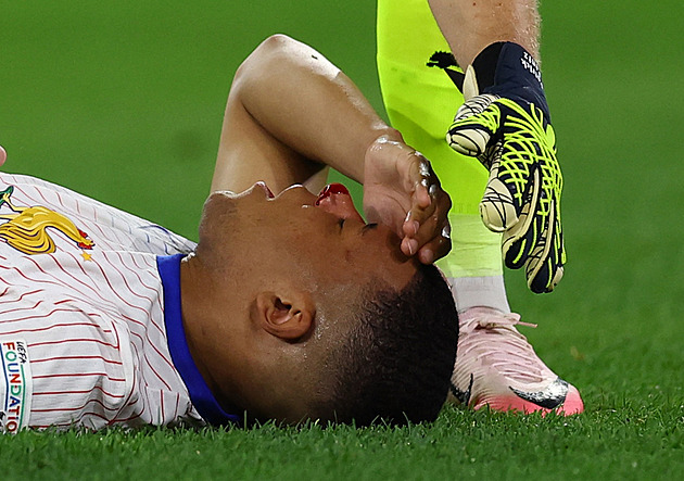 Rakousko - Francie 0:1, rozhodl vlastní gól, Mbappé po krvavém zranění střídal