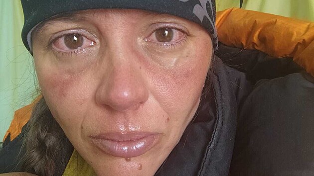 Monika Bene�ov� p�i zdol�v�n� Mount Everestu (kv�ten 2024)