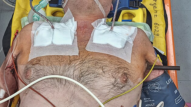 Mu�i, kter� spadl ze �eb��ku, pronikla do t�la kovov� ty�.