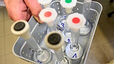 V�ra Barcalová, vedoucí laborato�e Spolchemie s rozpu�t�nými vzorky medu, z...