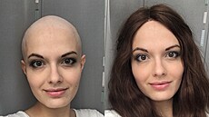 Nikola Musilová zjistila krátce po svých 25. narozeninách, �e trpí velmi...