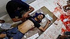 Palestinec je o�et�ován v Násirov� nemocnici po izraelském útoku v Chán Júnisu...