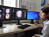 CT snímkování pomocí moderního poítaového tomografu v Radiodiagnostickém...