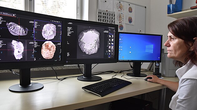 CT snmkovn pomoc modernho potaovho tomografu v Radiodiagnostickm oddlen Nemocnice Agel v Perov