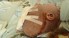 Karolínka po útoku matky