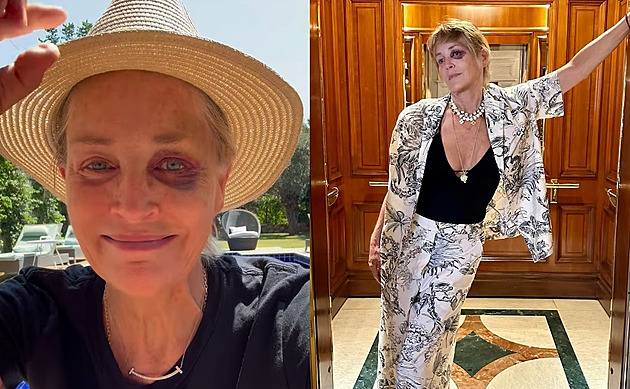 Výlet byl drsný, ale já jsem drsnější, řekla Sharon Stone s monoklem