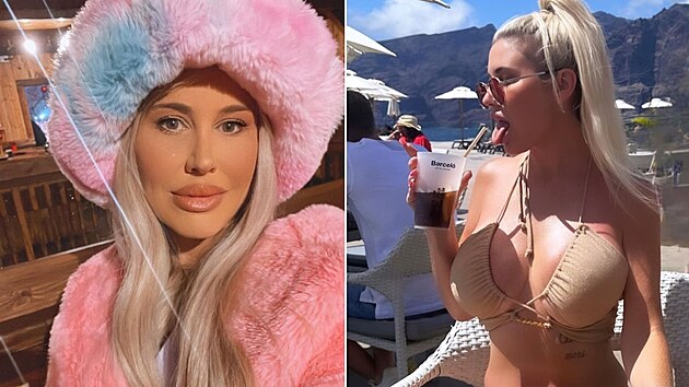 Modelka byla zvisl na alkoholu, dnes propaguje zdrav ivotn styl.