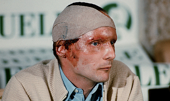 Salzburg, 8. záí 1976. Niki Lauda se k závodní vrátil 42 dní po nehod.